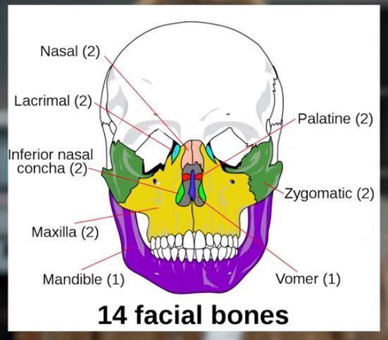 Facial bones.JPG