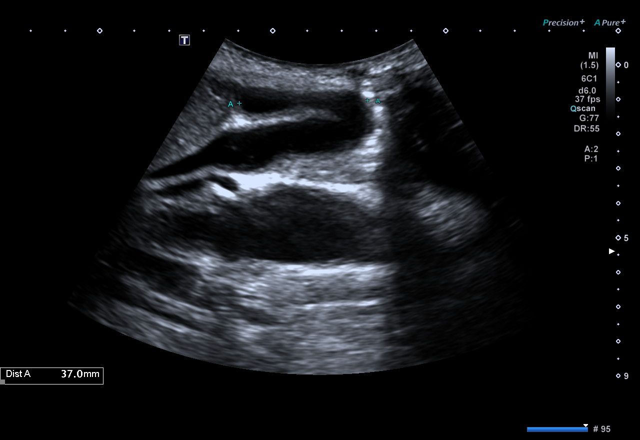 Gallbladder.jpg