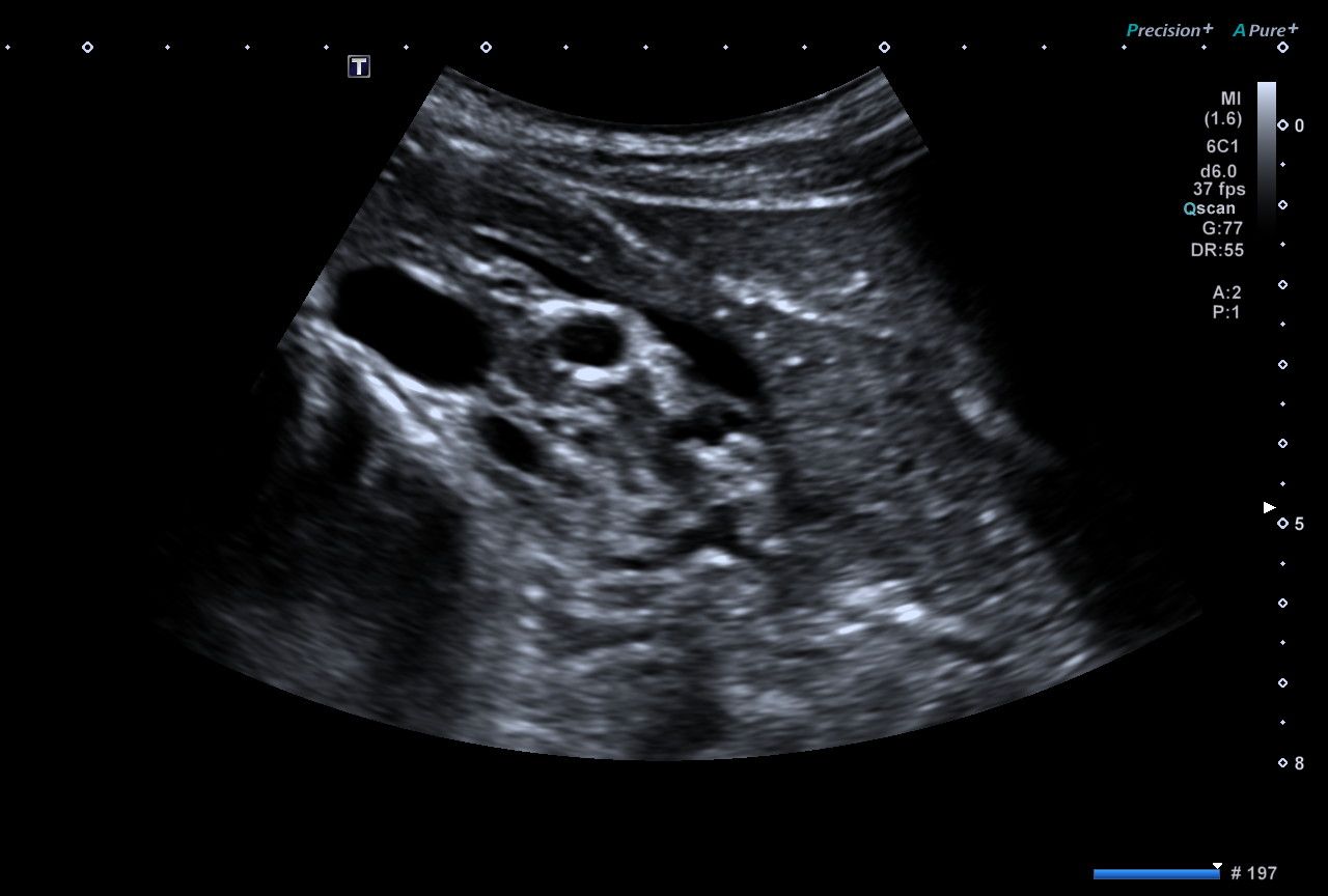 Pancreas.jpg