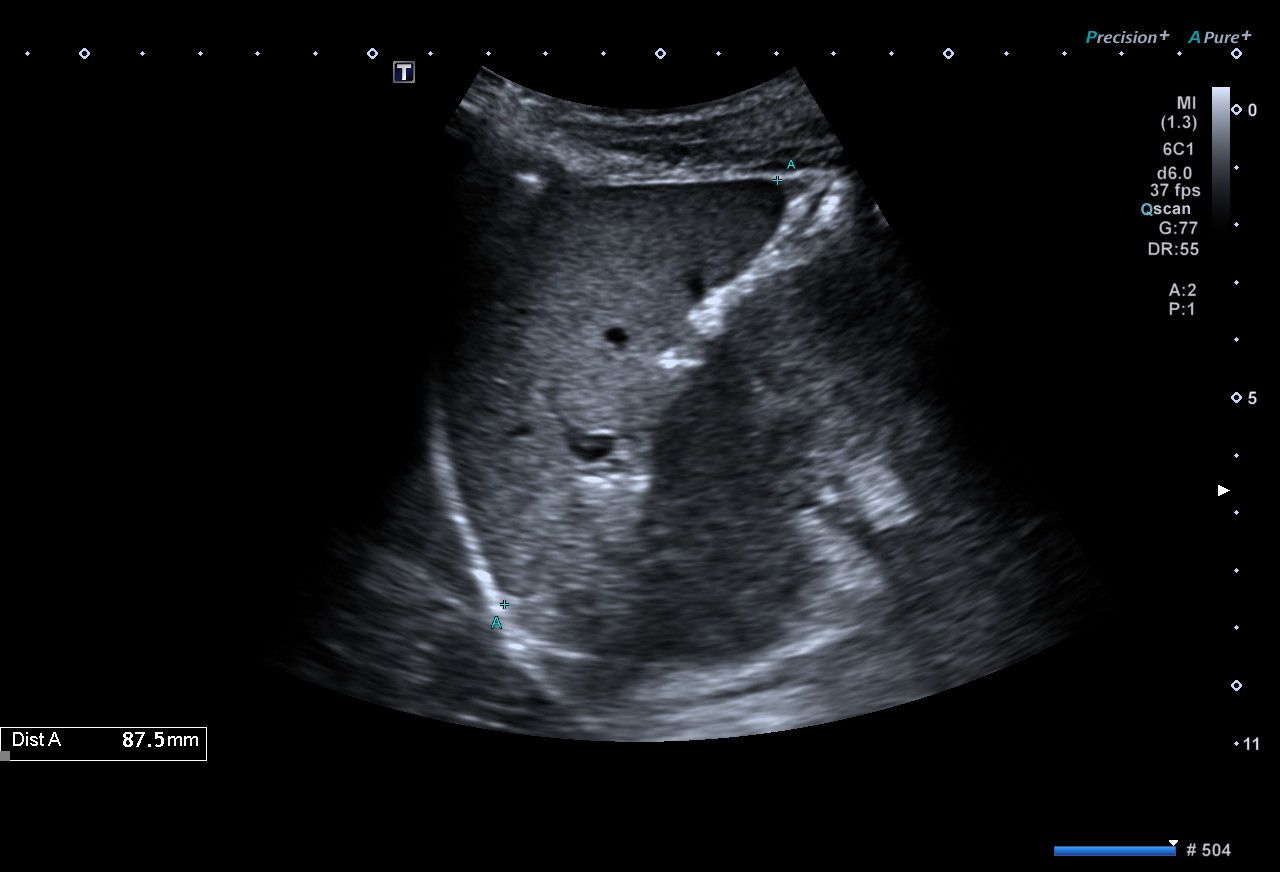 Spleen.jpg