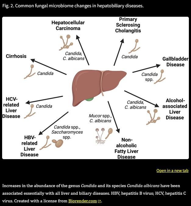 Common fungal microbiome changes in hepatobiliary diseases.jpg